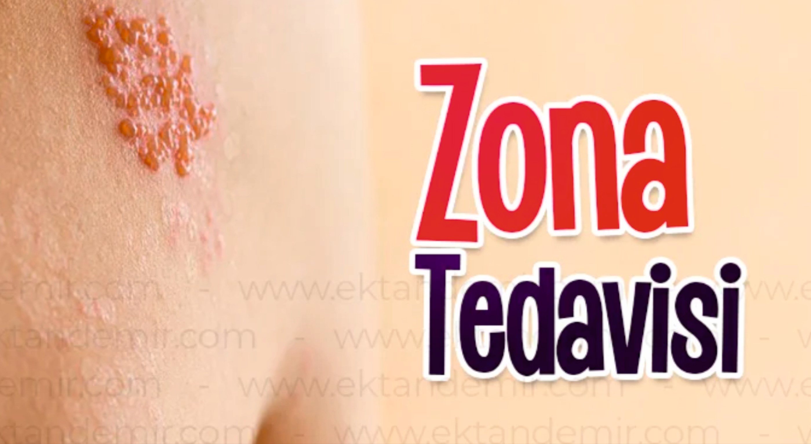 Zona Tedavisi Atasehir 01.Jpg