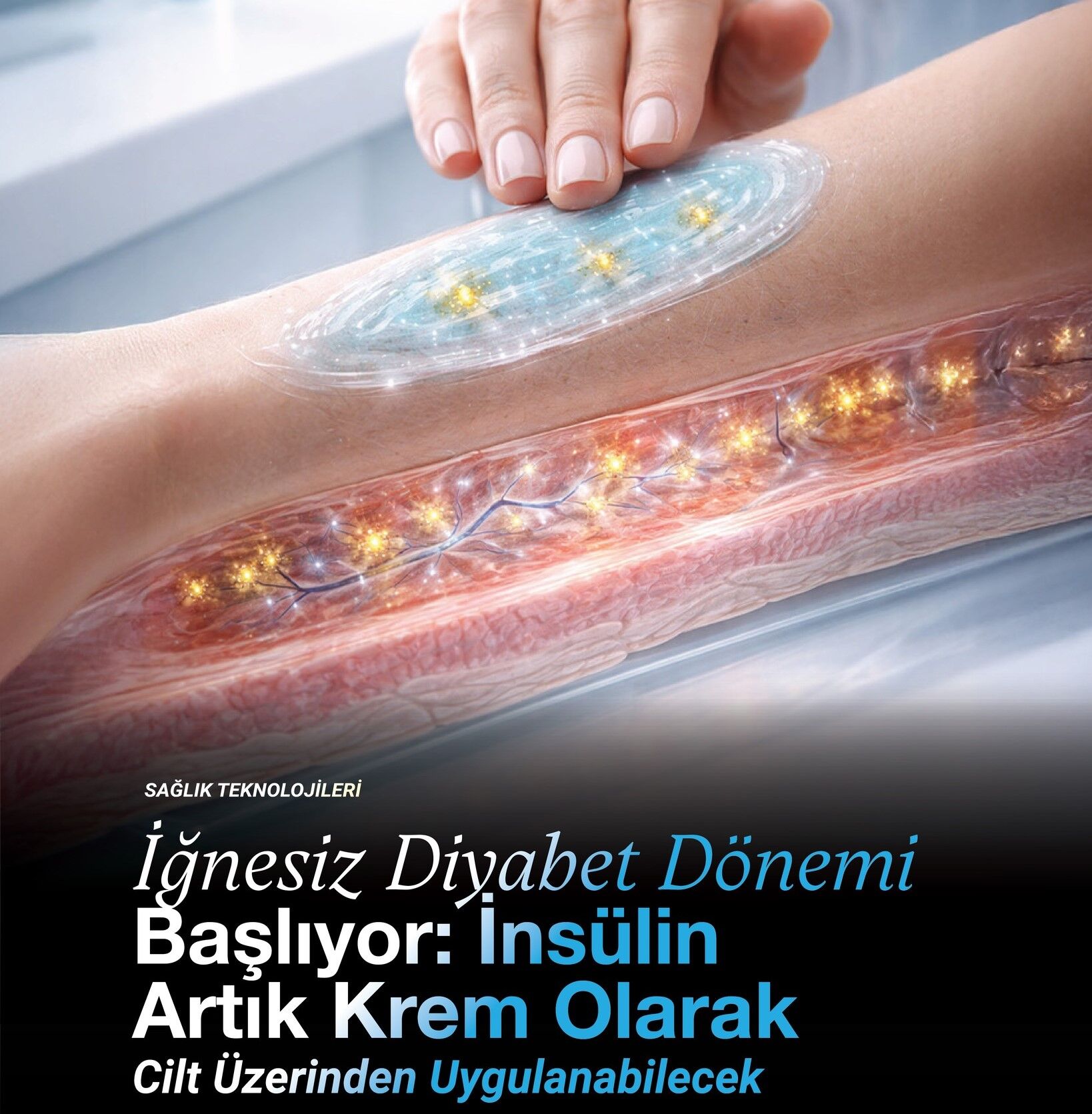 İğnesiz İnsülin Dönemi Başlıyor Bir Losyon Kadar Kolay (2)