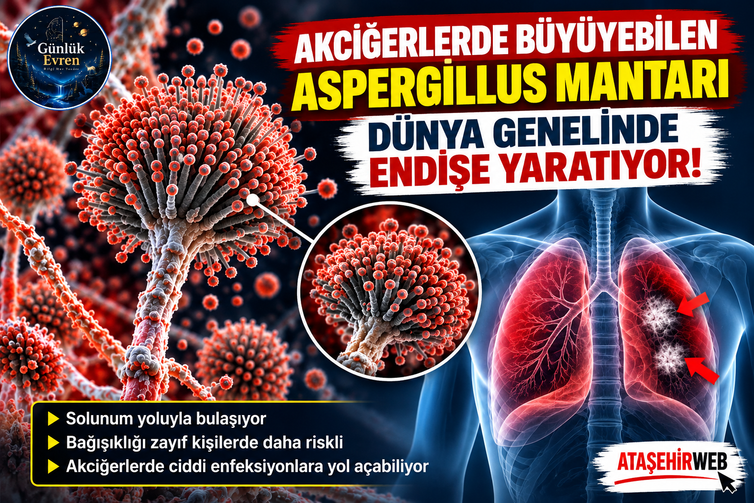 Aspergillus Mantarı Akciğerleri Tehdit Ediyor (1)