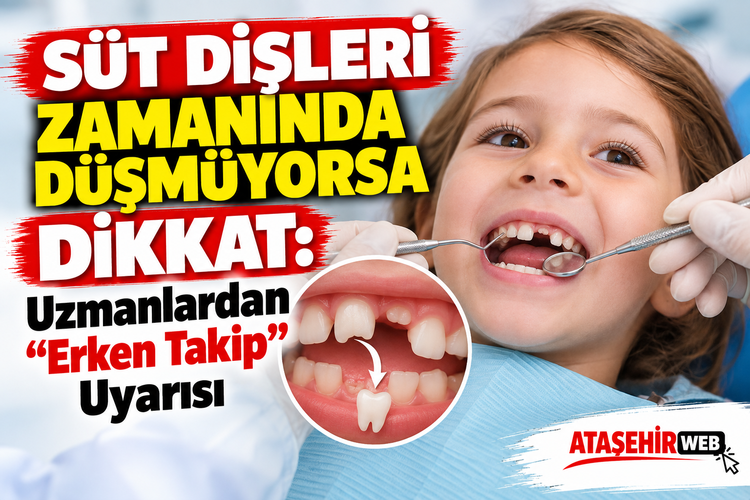 Süt Dişleri İçin Erken Takip Uyarısı