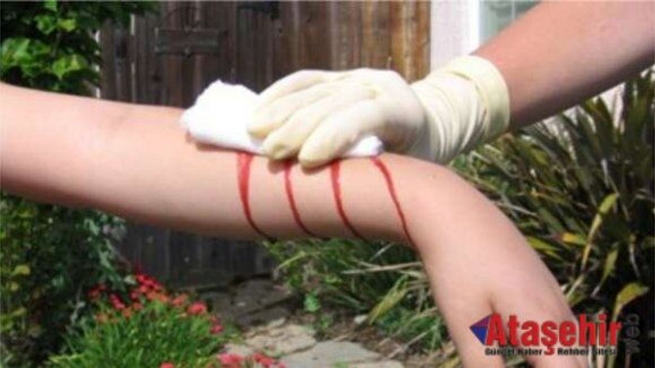 Bir dakikada kanı durduran jel geliştirildi