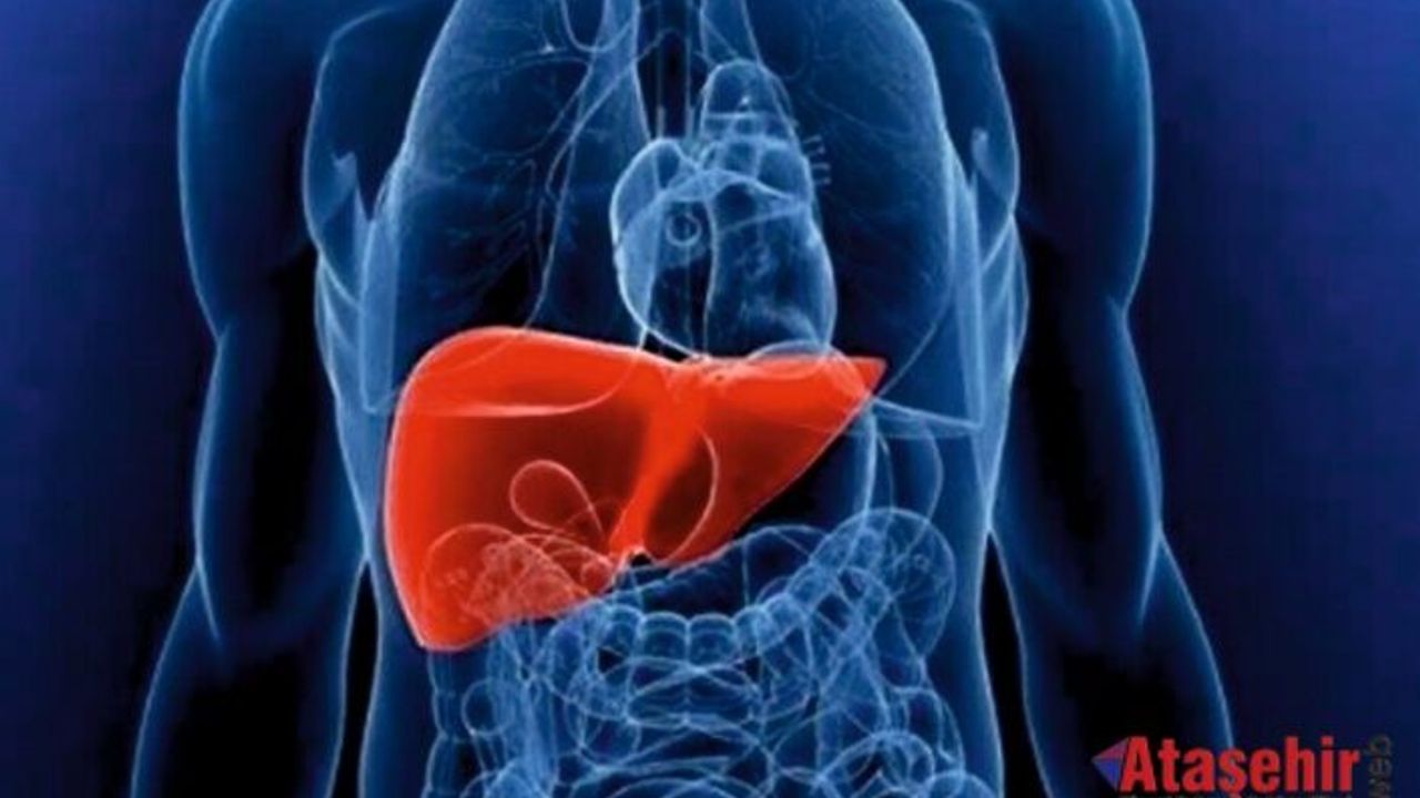 KARACİĞER KANSERİNDE  TARE YÖNTEMİ UMUT OLUYOR! 