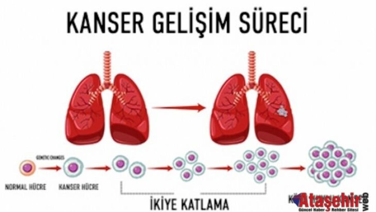 4. Evre Kanserde Tedavi Seçenekleri ve Umut