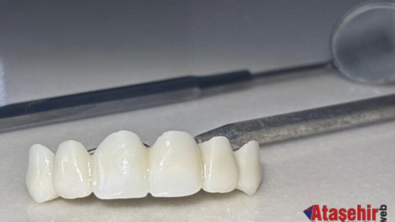 Sivas’ta Devlet Eliyle Gülümseme: Zirkonyum Kaplama Artık Herkes İçin Ulaşılabilir