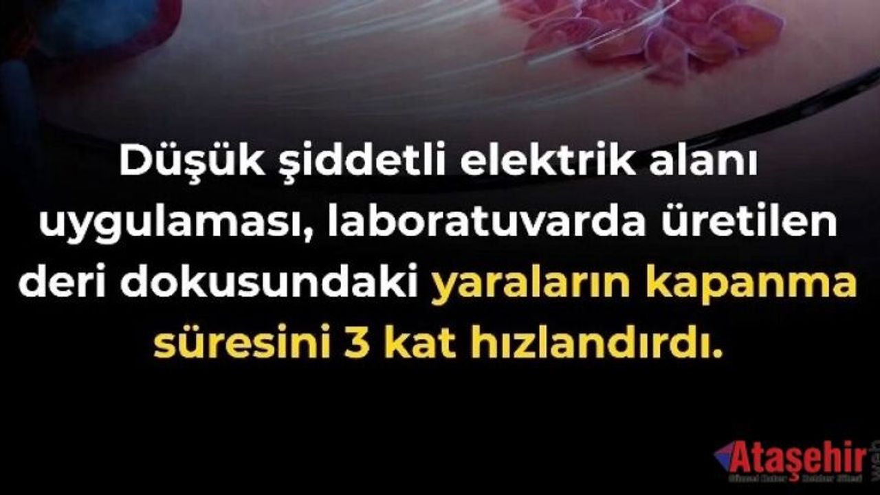 Elektrik Alanları Yara İyileşmesini Üç Kat Hızlandırabilir