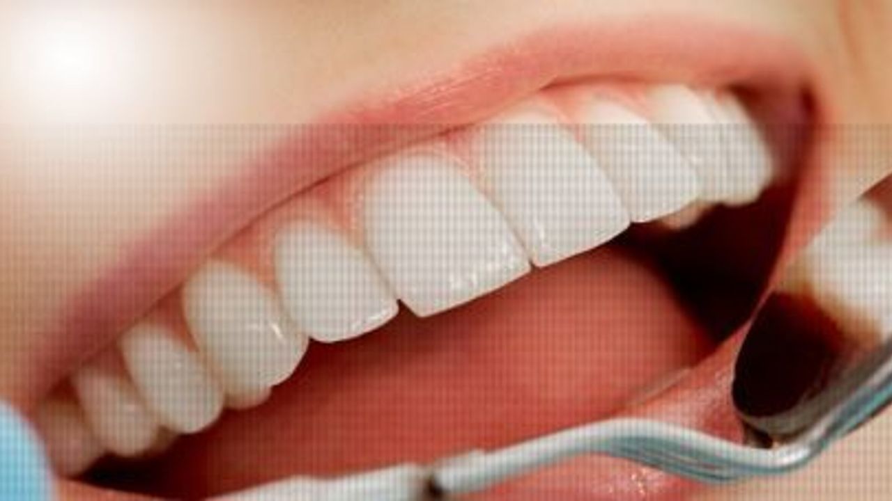 Acısız ve dolgusuz diş tedavi yöntemi geliştirildi