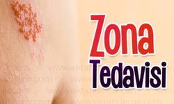 Zona Her 3 Kişiden Birinin Hayatını Etkiliyor