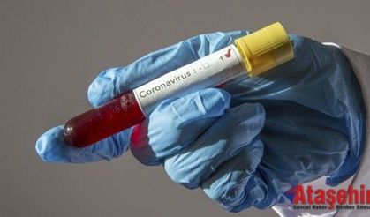 Kuzey Kıbrıs'ta bir aydır koronavirüs vakası görülmedi