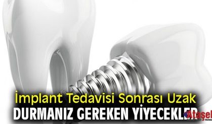 İmplant Tedavisi Sonrası Uzak Durmanız Gereken Yiyecekler