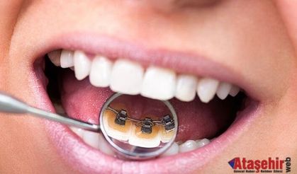 Estetik Diş Hekimliğinde Ortodonti