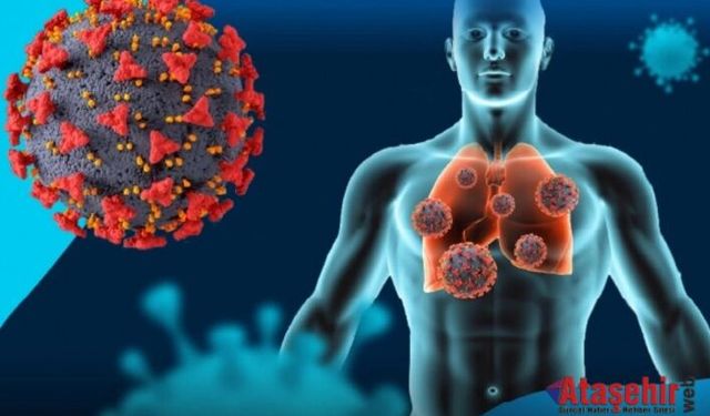 Yeni H3N2 Virüsü Kuzey Yarımkürede Yayılıyor