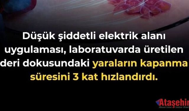 Elektrik Alanları Yara İyileşmesini Üç Kat Hızlandırabilir