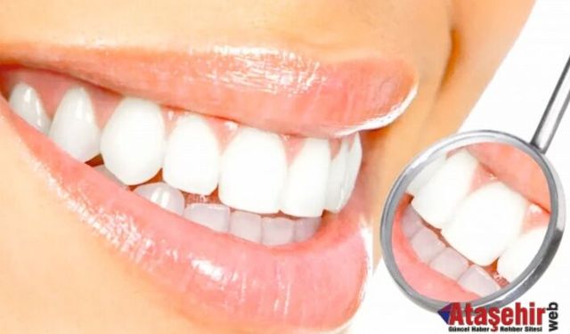 Diş beyazlatmada doğru bilinen yanlışlar!