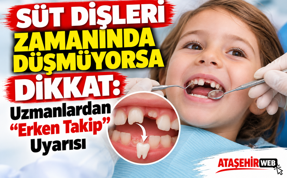 Süt Dişleri Zamanında Düşmüyorsa Dikkat: Uzmanlardan "Erken Takip" Uyarısı